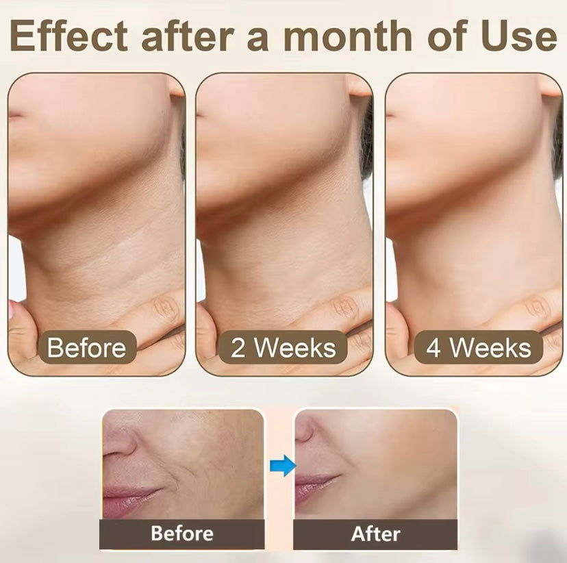 Microcurrent EMS Neck Massager, Face Lift Wrinkle Machine, Double Chin Remover, LED Photon Facial, Skin Tightening Massager