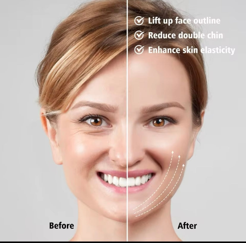 EMS Facelifting-Massagegerät, Anti-Falten-Lifting, V-Linie, Facelifting-Gerät, Mikrostrom-Entferner, Doppelkinn-Hautpflege
