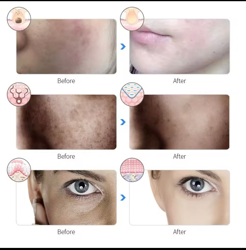 Rechargeable LED Facial Mask 7 Colors LED Photon Therapy Beauty Mask Skin Rejuvenation Home Face Lifting Whitening Beauty Device